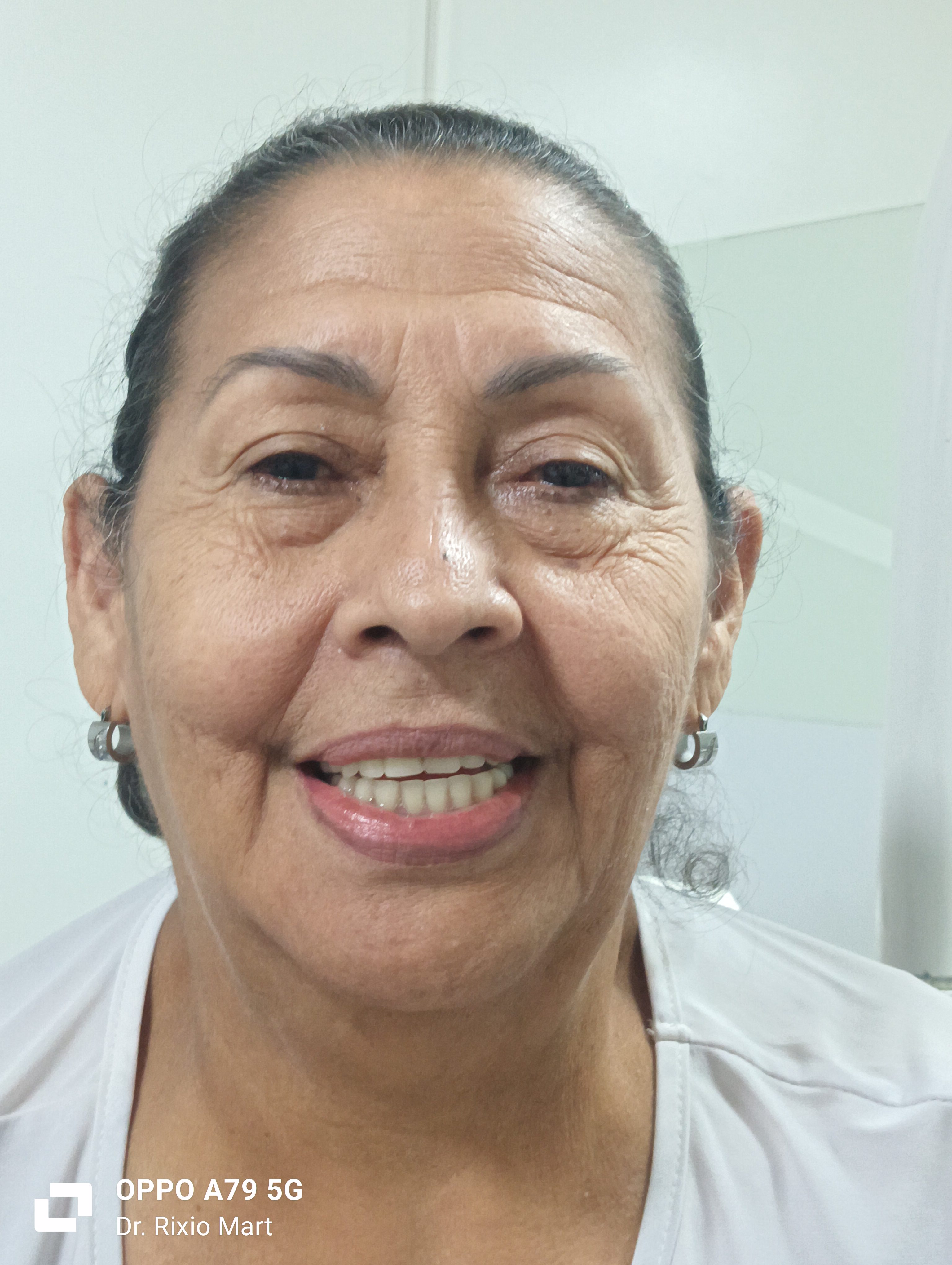 Paciente con su nueva sonrisa